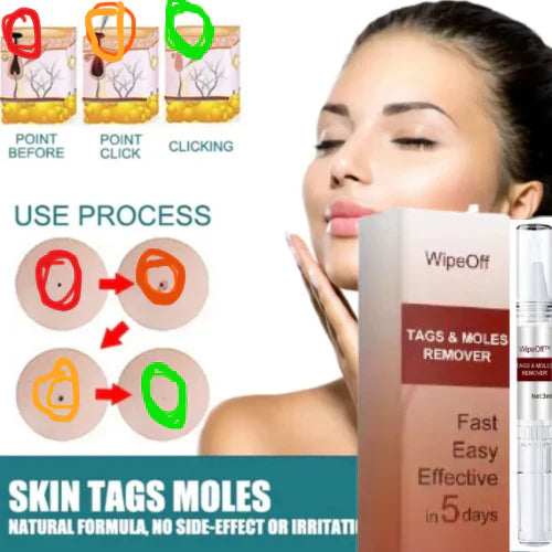 Stylo Anti-Acrochordons - Essence Naturelle pour Éliminer Taches et Grains de Beauté