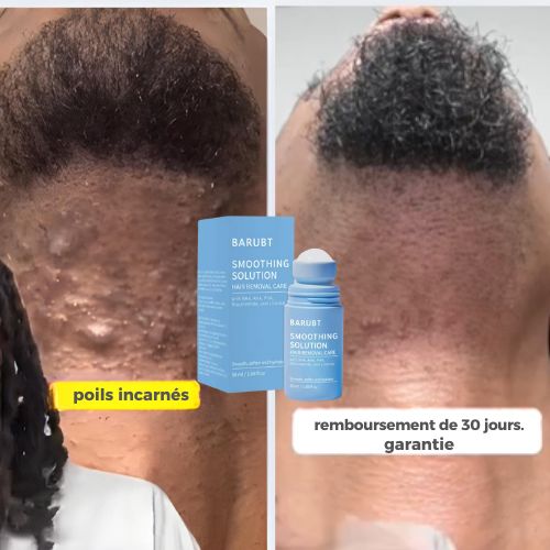 Traitement Anti-Bosses de Rasoir et Poils Incarnés - Solution Dermatologique.TG/Lomé