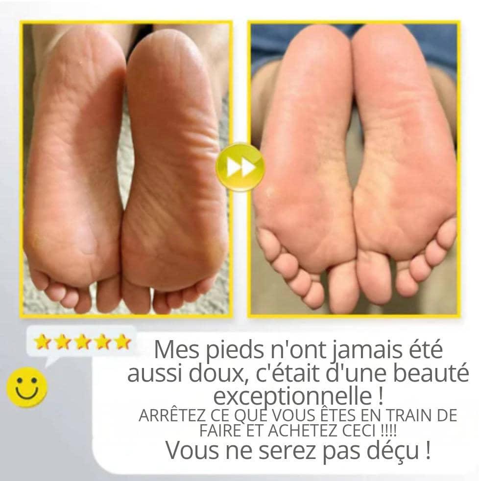 Rape Electrique et Rechargeable pour Pieds