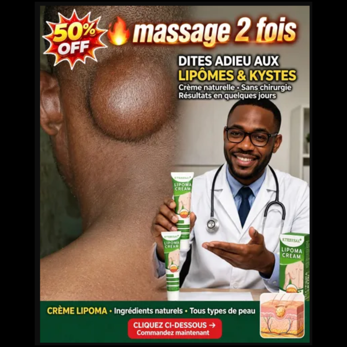 Retrouvez la confiance grâce à la CRÈME LIPOMA. GB