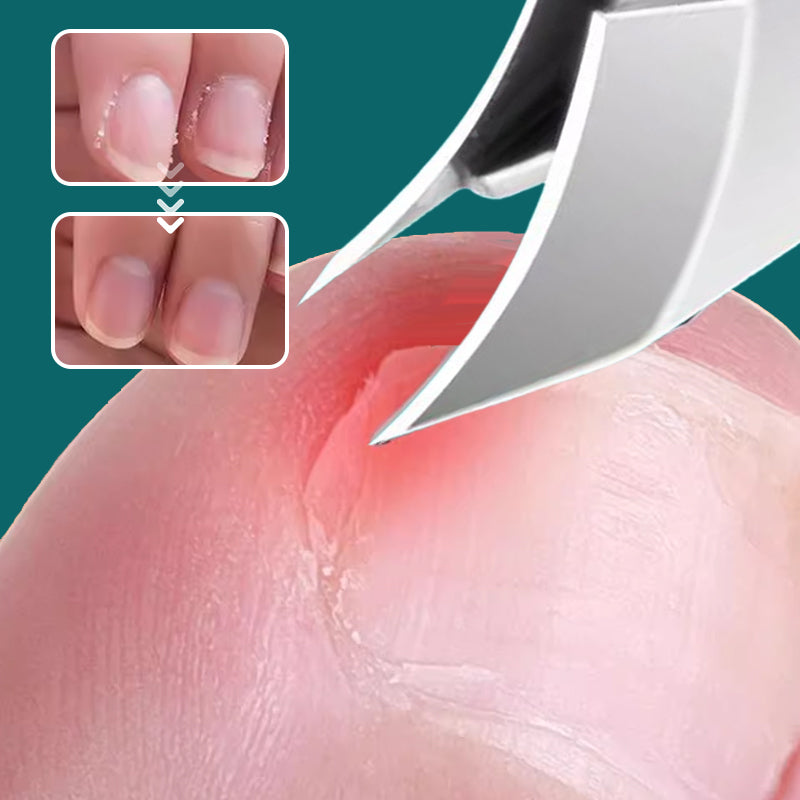Set de 3 pièces de coupe-ongle. BF